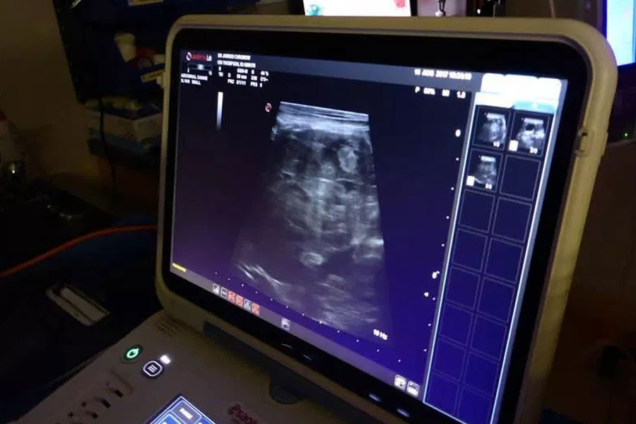 Hilton Vet Hospital - Pet Pregnancy Ultrasound Scanning